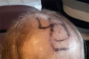 На голове пожилого мужчины нарисовали свастику