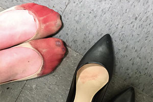 Официантка разбила ноги в кровь на работе 