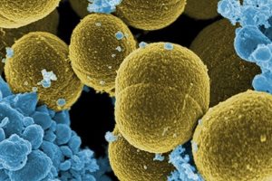 Смертельная грибковой инфекция в Канаде